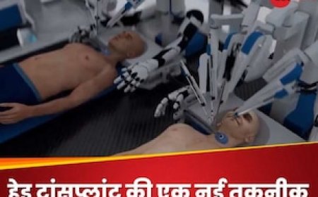 दुनिया का पहला हेड ट्रांसप्लांट सिस्टम! रोबोट ने Video में दिखाया डेमो तो ताकती रह गई दुनिया
