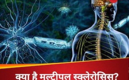 सबसे खतरनाक ऑटोइम्यून डिजीज मल्टीपल स्क्लेरोसिस, न्यूरोलॉजिस्ट ने बताया दिमाग-रीढ़ होने लगता है कमजोर; जानें लक्षण बचाव के उपाय