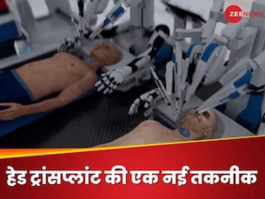 दुनिया का पहला हेड ट्रांसप्लांट सिस्टम! रोबोट ने Video में दिखाया डेमो तो ताकती रह गई दुनिया