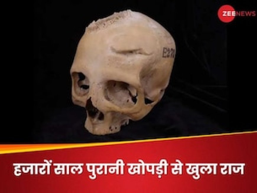 प्राचीन काल में भी होता था कैंसर का इलाज! 4000 साल से भी पुरानी खोपड़ी ने खोला राज