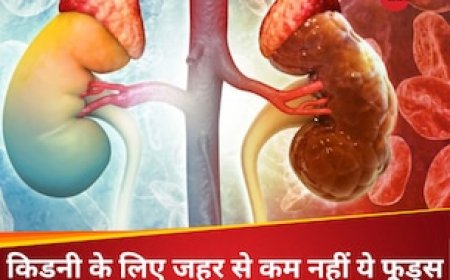 5 फूड्स किडनी के लिए जहर से कम नहीं, रोजाना खा रहे हैं तो जल्दी ही हो सकती है Kidney Damage
