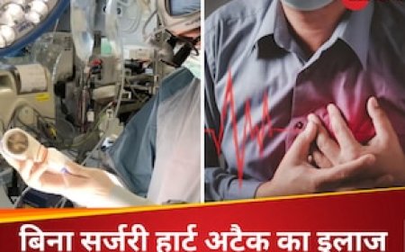 हार्ट अटैक के बाद बाईपास सर्जरी की नहीं पड़ेगी जरूरत, इस छोटे से टूल से ठीक किया जाएगा डैमेज मसल्स
