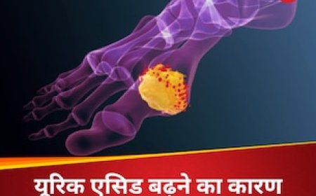 शरीर में कब बढ़ने लगता है यूरिक एसिड? जानें गठिया बनने से पहले कैसे करें कंट्रोल