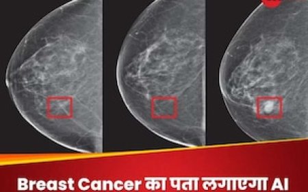 AI के जरिए 5 साल पहले डिटेक्ट हो पाएगा ब्रेस्ट कैंसर, जानिए नई तकनीक कैसे करेगी काम