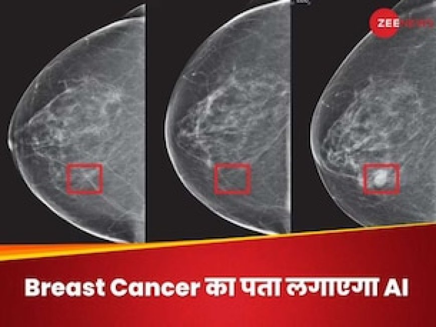 AI के जरिए 5 साल पहले डिटेक्ट हो पाएगा ब्रेस्ट कैंसर, जानिए नई तकनीक कैसे करेगी काम
