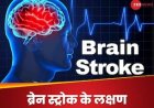 ठंड बढ़ते ही दिमाग को लगने लगा जोर का झटका! ब्रेन स्ट्रोक के लक्षण पहचानें, वरना पड़ेगा पछताना
