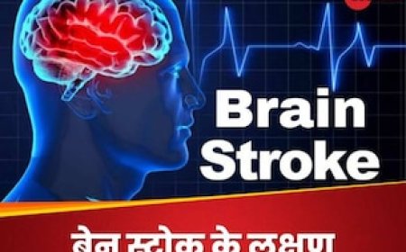 ठंड बढ़ते ही दिमाग को लगने लगा जोर का झटका! ब्रेन स्ट्रोक के लक्षण पहचानें, वरना पड़ेगा पछताना